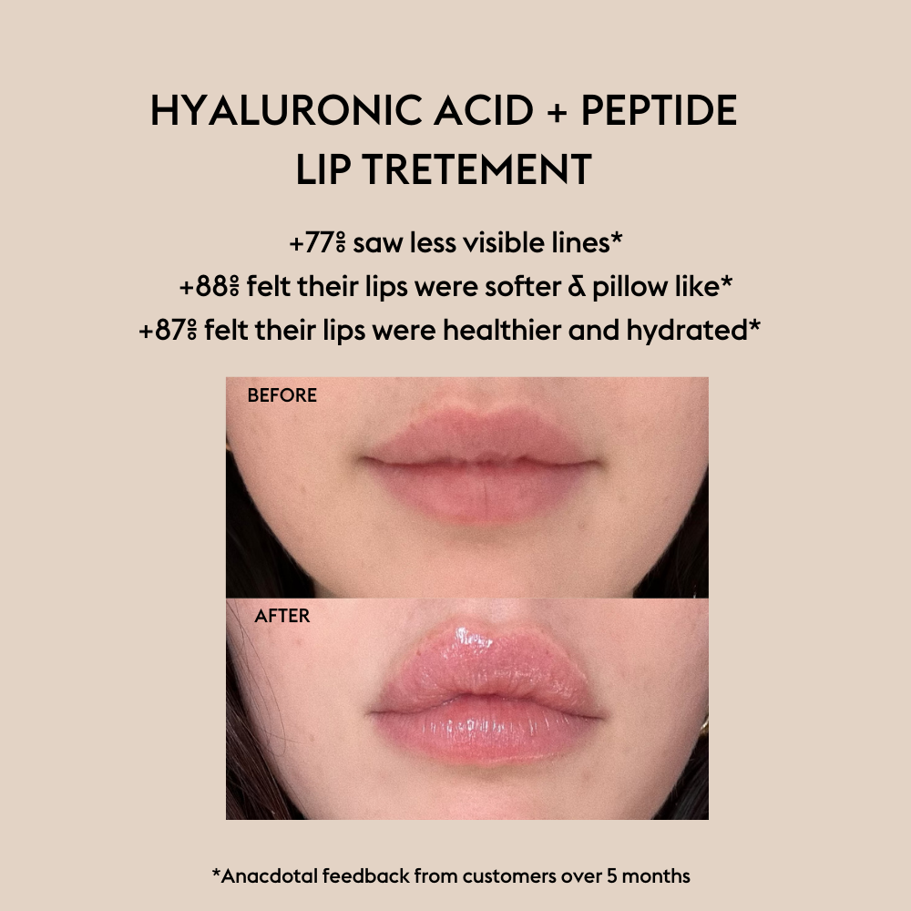 They Call Her Alfie - WATERMELON- Hyaluronic Acid + Peptide Lip Treatment